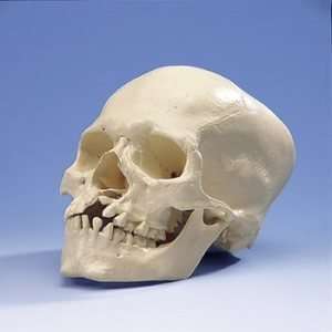 Human Skull with Cleft Jaw and Palate