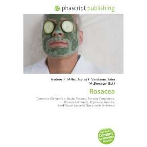 Rosacea 9786134016087  Books