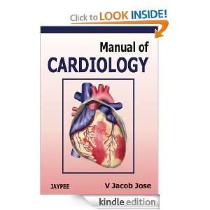 Manual of Cardiology Jose V Jacob  Kindle Store